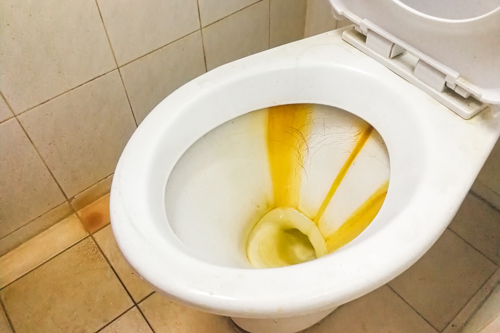 Poopy Toilet Overflowing